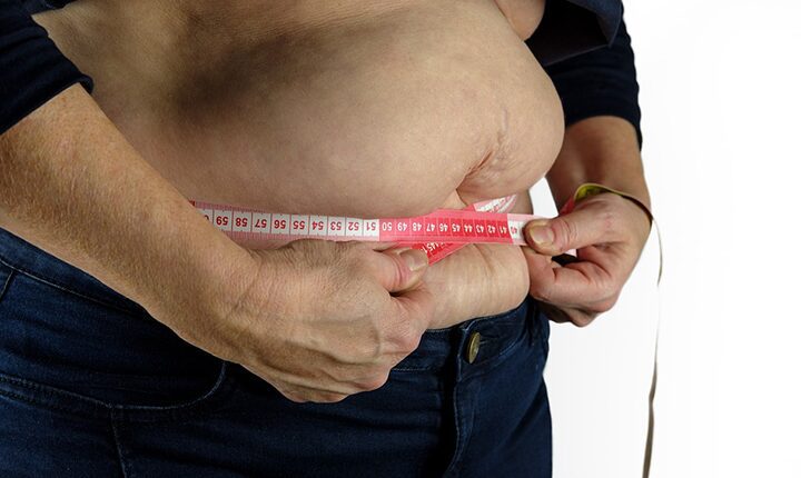 O que é preciso saber sobre obesidade
