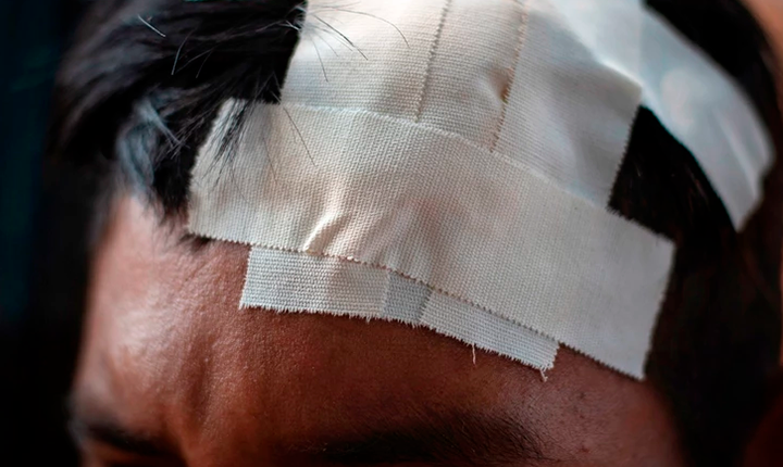 Racismo é comum durante atendimento médico em Dourados: por conta da hostilidade, indígenas temem ir ao hospital
