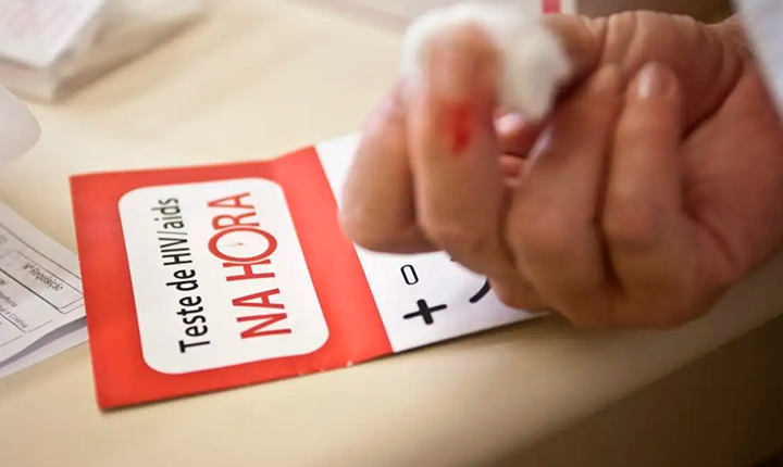 Aids: Brasil tem alta de casos, mas menor mortalidade desde 2013