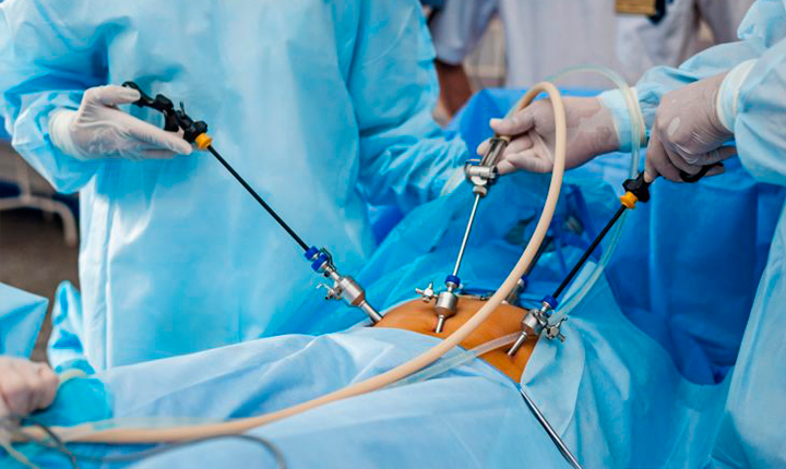 MS amplia acesso à cirurgia bariátrica com triagem criteriosa e novas referências