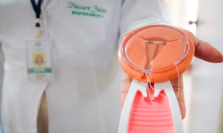 MS fortalece distribuição gratuita de contraceptivos de longa duração