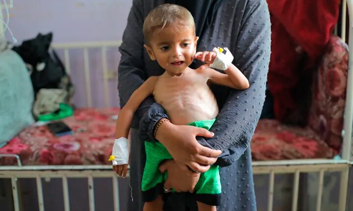 Fome em Gaza ameaça 640 mil palestinos: 12 mil crianças em desnutrição grave