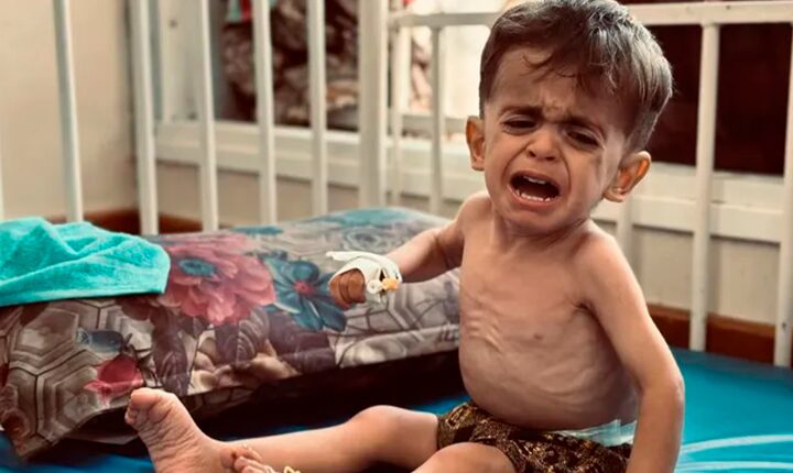 Israel encerra corredor humanitário em Gaza e agrava fome infantil