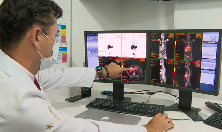 Pacientes com câncer colorretal são diagnosticados em estágio avançado